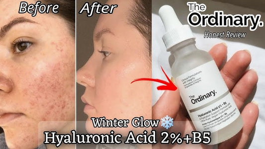 The Ordinary Niacinamide 10% + Zinc 1% ( Original with batch code )