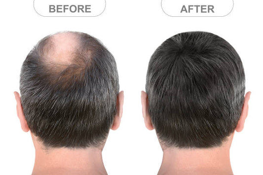 Hair Food Oil For Hair